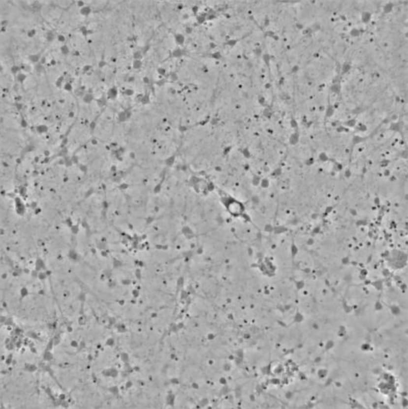 When sensitive primary Mouse Neurons dispensed with the MANTIS (1)