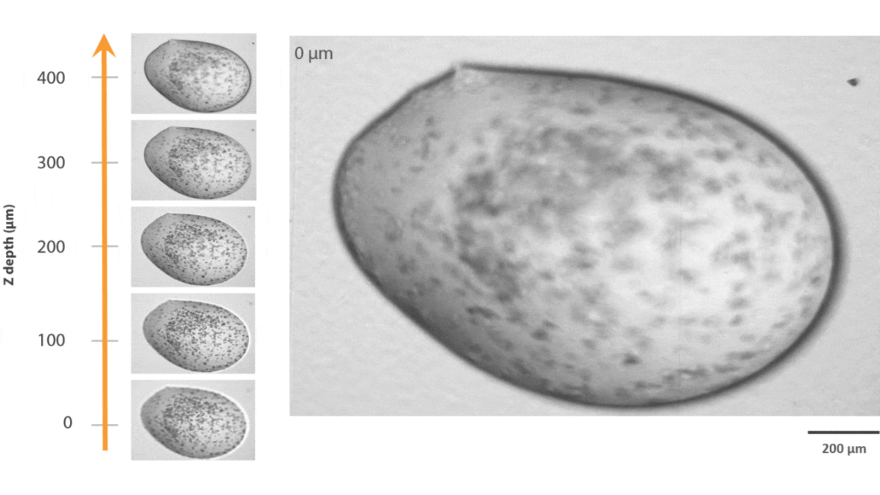 extended focus imaging EFI
