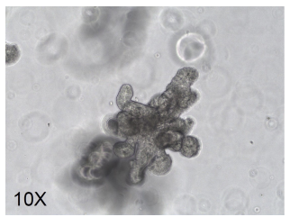 Organoid Culture